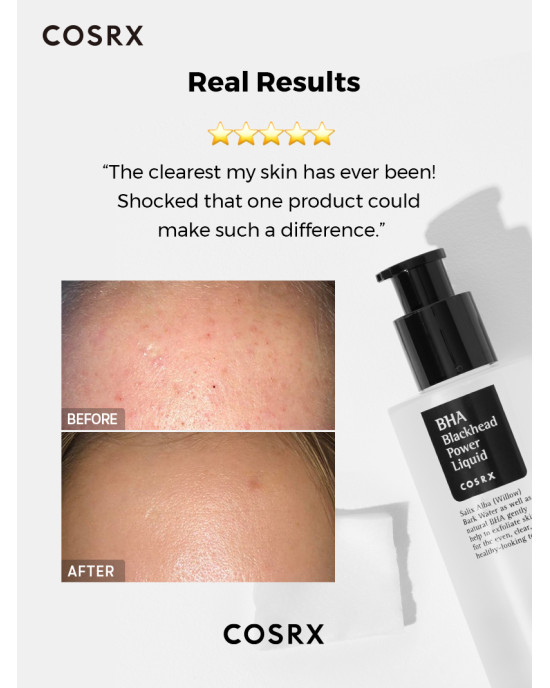 COSRX - BHA Blackhead Power Liquid 100ml